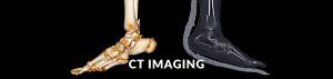 CT scan photo header